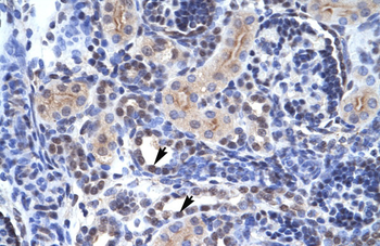 TAF1 Rabbit Polyclonal Antibody