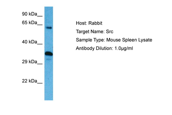 SRC Rabbit Polyclonal Antibody