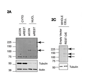 REST Rabbit Polyclonal Antibody