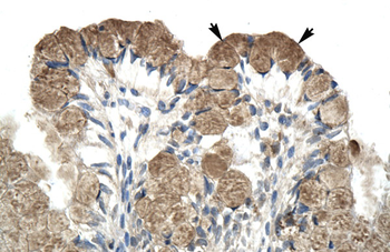 NCOR1 Rabbit Polyclonal Antibody