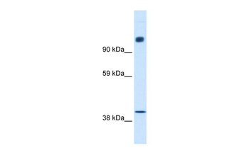 NCOR1 Rabbit Polyclonal Antibody