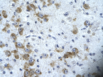 CIC Rabbit Polyclonal Antibody