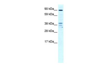 ZC3H7B Rabbit Polyclonal Antibody