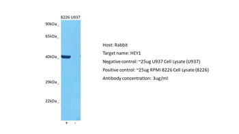 HEY1 Rabbit Polyclonal Antibody