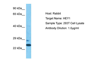 HEY1 Rabbit Polyclonal Antibody