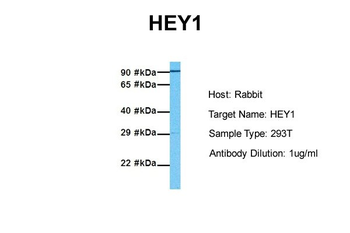 HEY1 Rabbit Polyclonal Antibody