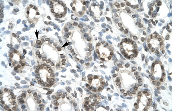 HEY1 Rabbit Polyclonal Antibody
