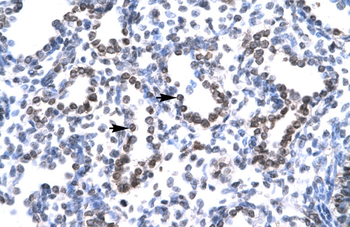 HEY1 Rabbit Polyclonal Antibody
