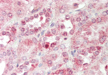 SEC14L2 Rabbit Polyclonal Antibody