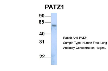 PATZ1 Rabbit Polyclonal Antibody