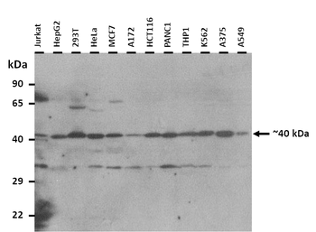 NOCT Rabbit Polyclonal Antibody