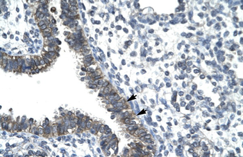 NOCT Rabbit Polyclonal Antibody