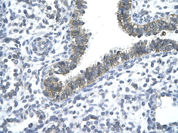 NOCT Rabbit Polyclonal Antibody