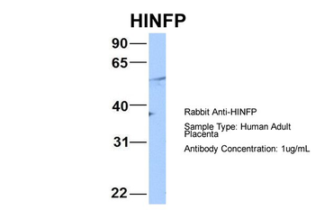 MIZF Rabbit Polyclonal Antibody