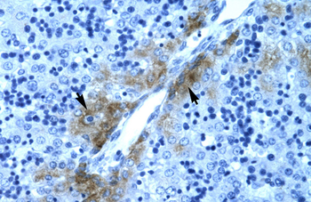 GATA3 Rabbit Polyclonal Antibody
