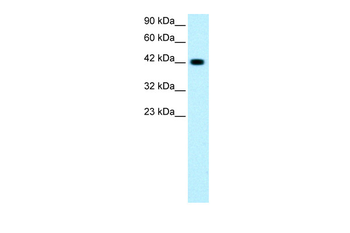 GATA3 Rabbit Polyclonal Antibody