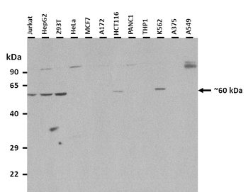 GATA6 Rabbit Polyclonal Antibody