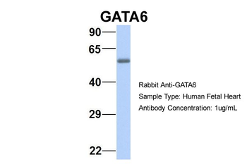GATA6 Rabbit Polyclonal Antibody