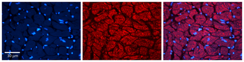 SND1 Rabbit Polyclonal Antibody