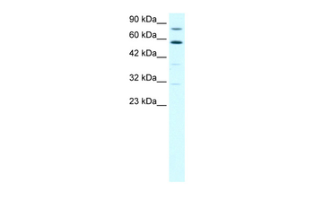 SND1 Rabbit Polyclonal Antibody