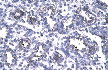 FOXP1 Rabbit Polyclonal Antibody