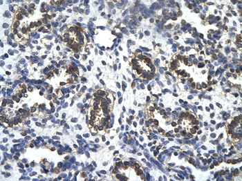 TAF5L Rabbit Polyclonal Antibody