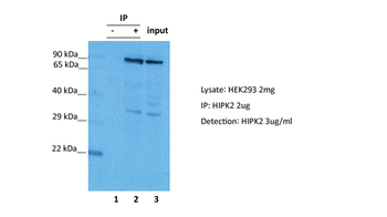HIPK2 Rabbit Polyclonal Antibody
