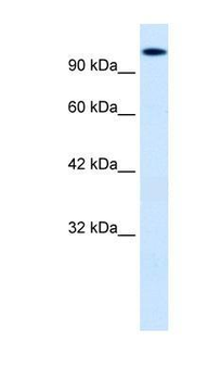 HIPK2 Rabbit Polyclonal Antibody
