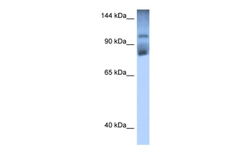 HIPK2 Rabbit Polyclonal Antibody