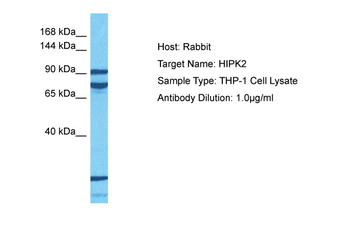 HIPK2 Rabbit Polyclonal Antibody