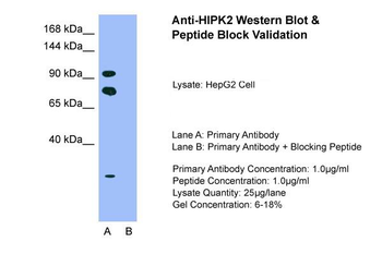 HIPK2 Rabbit Polyclonal Antibody