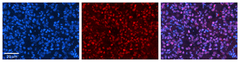 HIPK2 Rabbit Polyclonal Antibody