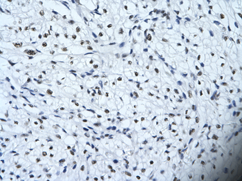 HIPK2 Rabbit Polyclonal Antibody