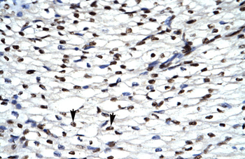 HIPK2 Rabbit Polyclonal Antibody