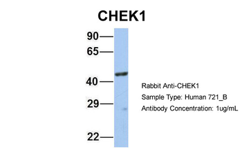 CHEK1 Rabbit Polyclonal Antibody