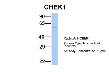 CHEK1 Rabbit Polyclonal Antibody