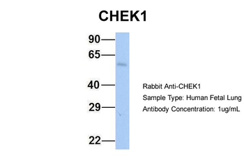 CHEK1 Rabbit Polyclonal Antibody