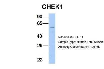 CHEK1 Rabbit Polyclonal Antibody