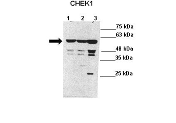 CHEK1 Rabbit Polyclonal Antibody