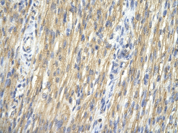 CHEK1 Rabbit Polyclonal Antibody
