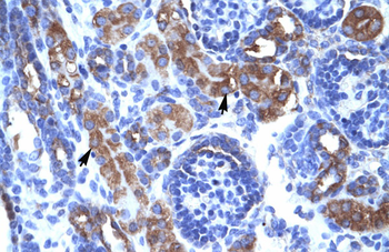 CHEK1 Rabbit Polyclonal Antibody