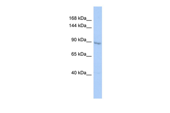 UHRF1 Rabbit Polyclonal Antibody