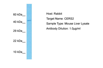 LASS2 Rabbit Polyclonal Antibody