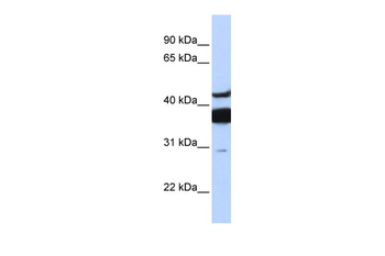 LASS2 Rabbit Polyclonal Antibody