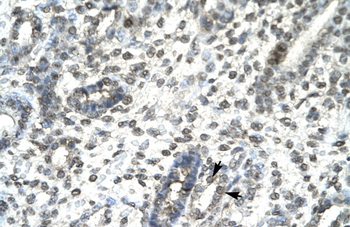 TBX21 Rabbit Polyclonal Antibody