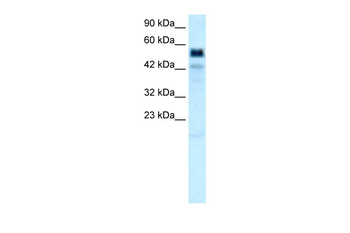 TBX21 Rabbit Polyclonal Antibody