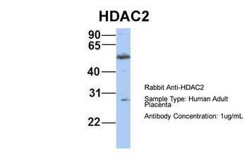 HDAC2 Rabbit Polyclonal Antibody