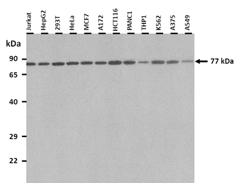 HIC1 Rabbit Polyclonal Antibody