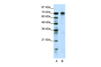 HIC1 Rabbit Polyclonal Antibody