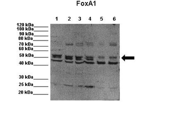 FOXA1 Rabbit Polyclonal Antibody